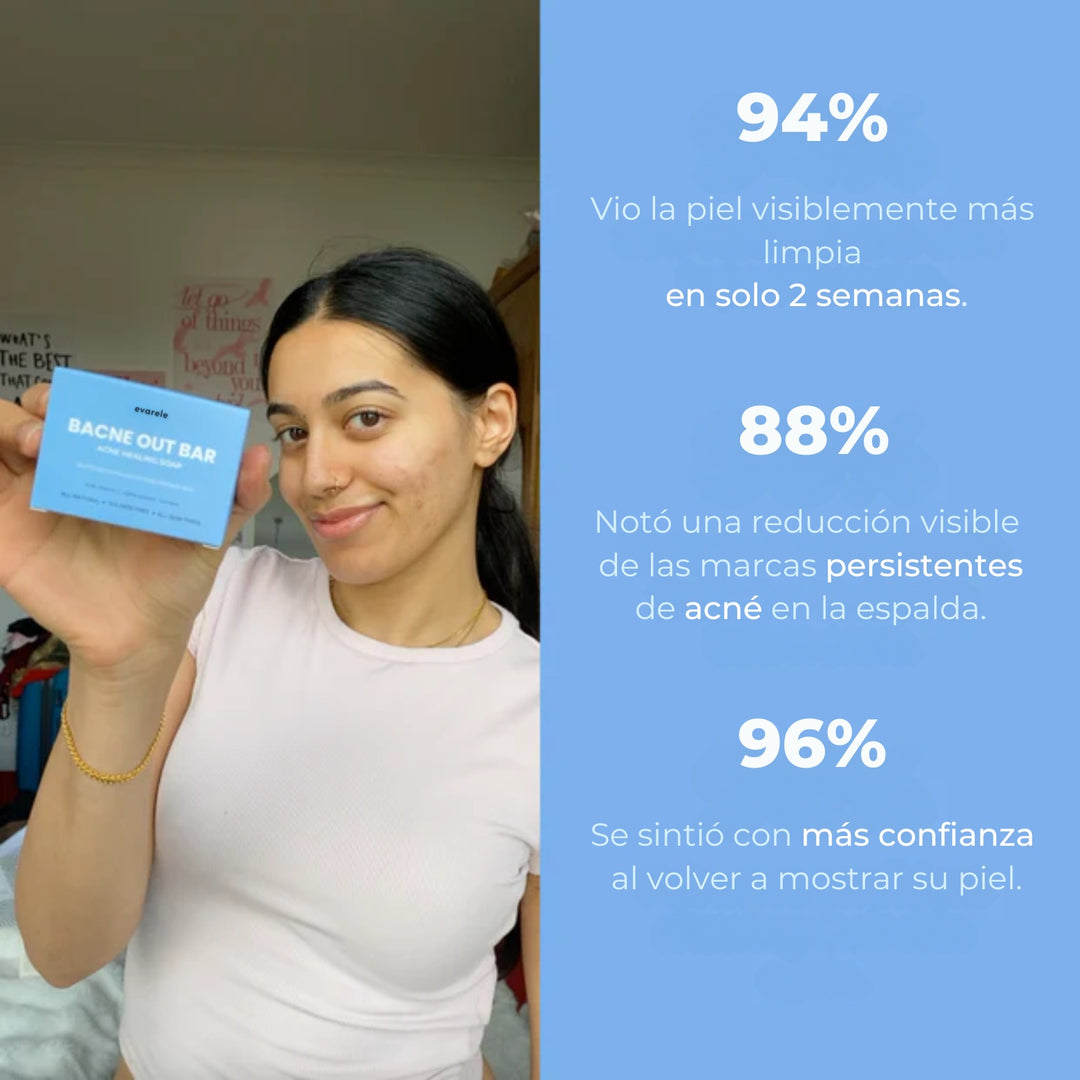 Barra Antiacné™