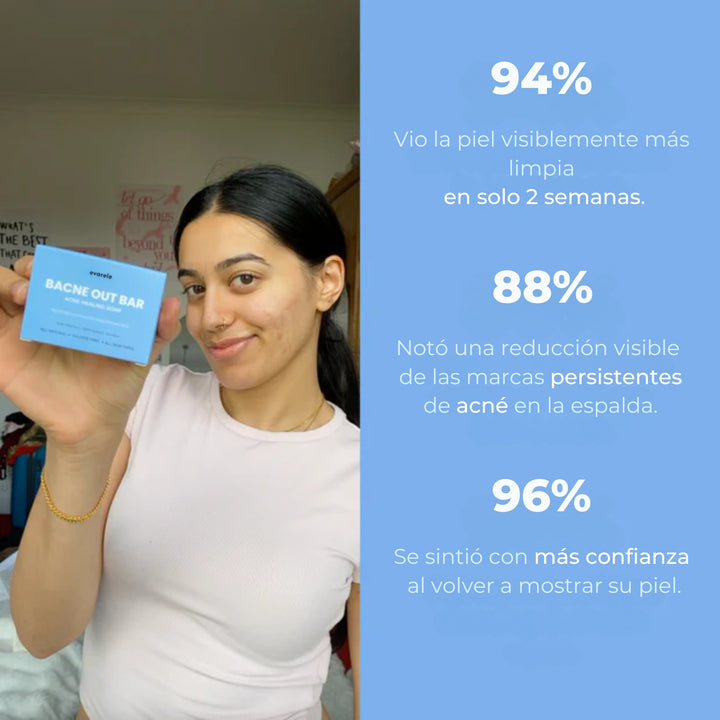 Barra Antiacné™